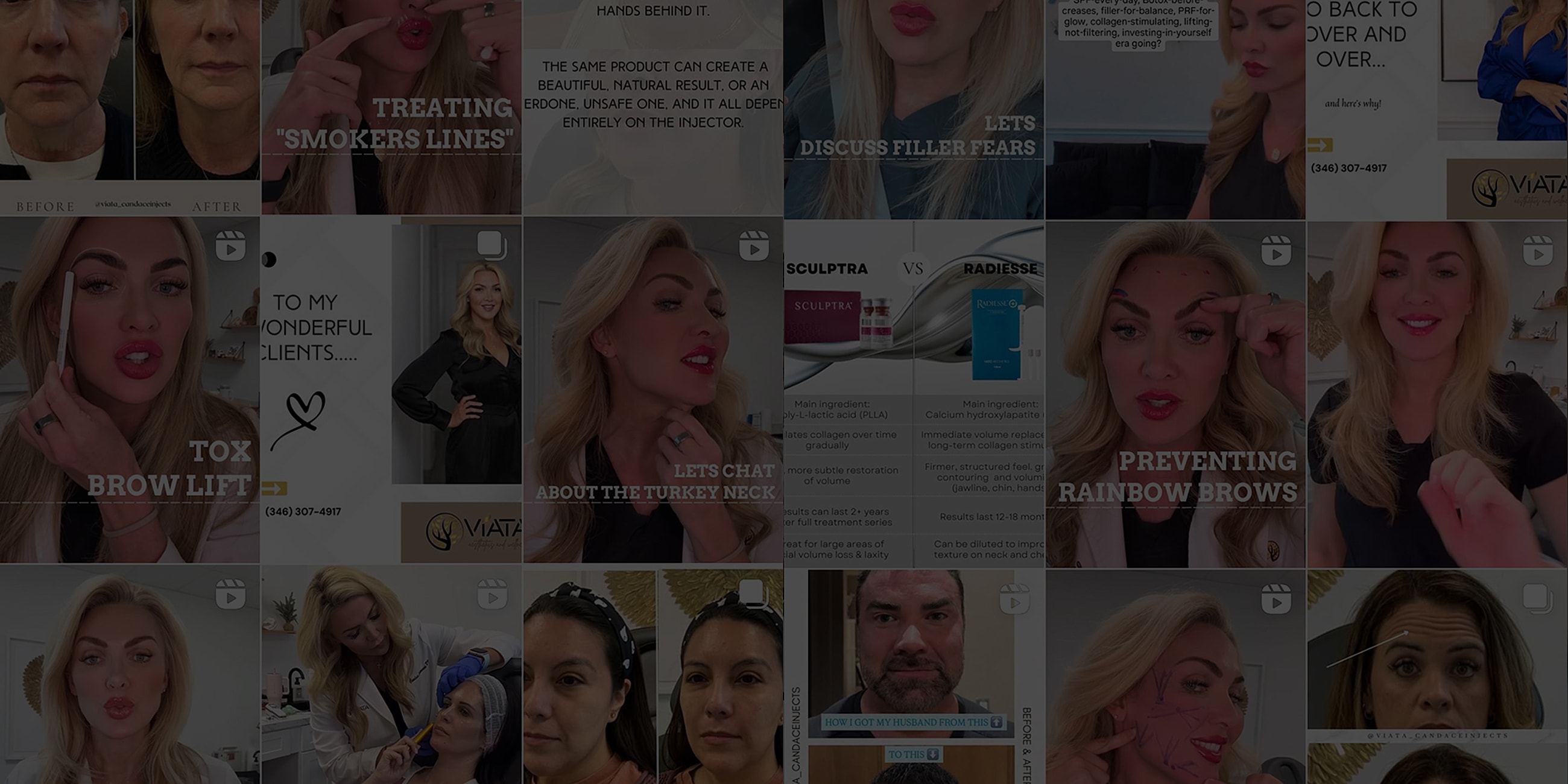 Cosmetic treatment tips and client transformations.