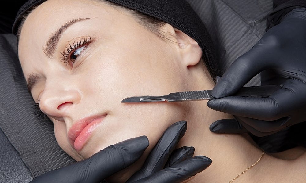 Dermaplaning: The Ultimate Guide to Reveal Smooth, Glowing Skin