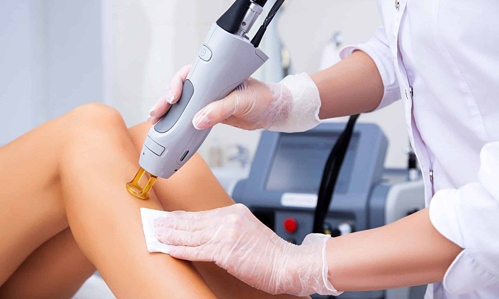 What to Expect During Your Laser Hair Removal Session